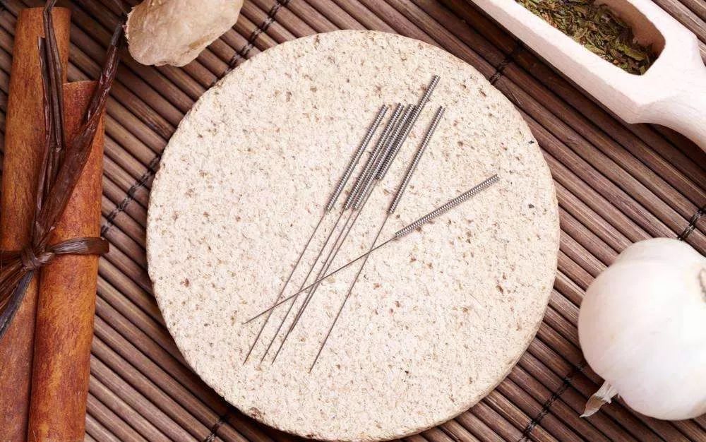 针灸可以用于麻醉，你知道吗？——写在针刺麻醉发展60余年