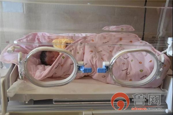 这个35+3周的宝宝出生时脐带扭成了麻花，且呈紫红色……