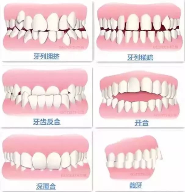 不到1折疯抢！全家口腔健康有保证~29.9元抢购原价895元劲松牙科家庭口腔护理套餐！超声波洁牙+中老年口腔护理+儿童口腔护理…