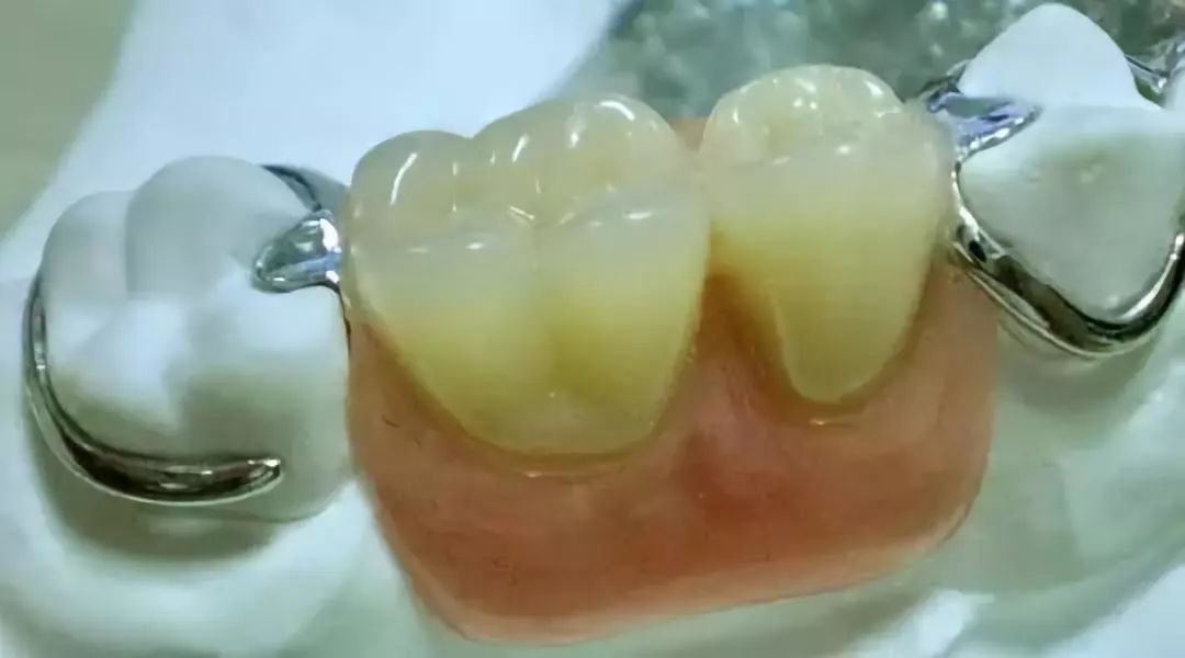 不到1折疯抢！全家口腔健康有保证~29.9元抢购原价895元劲松牙科家庭口腔护理套餐！超声波洁牙+中老年口腔护理+儿童口腔护理…