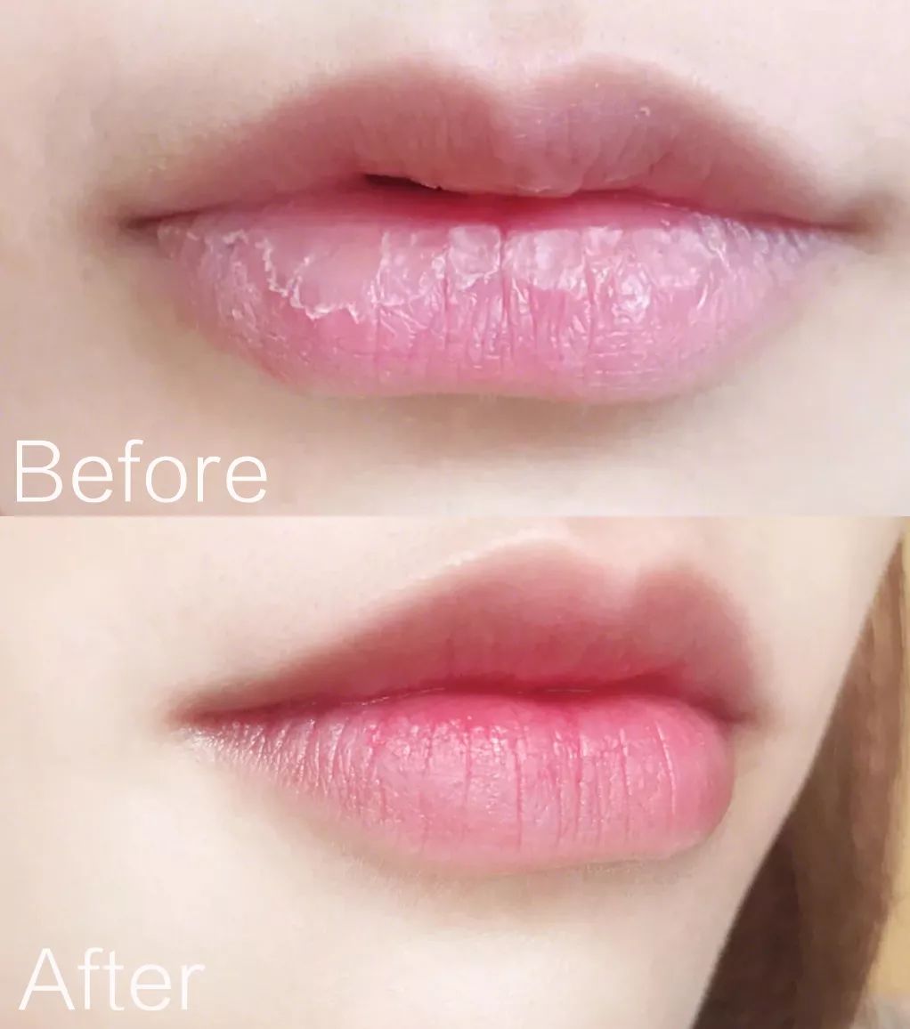 软化死皮淡化唇纹唇膜,唇霜去死皮淡化唇色