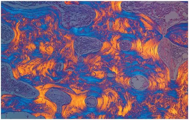 直到看了病理医生切的片子，我才明白了什么叫「艺术细胞」