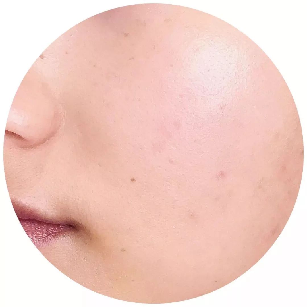 日本推荐本土美白丸,美白丸推荐日本