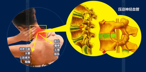 心悸胸闷头晕怎么回事,头晕心悸胸闷气短乏力嗜睡