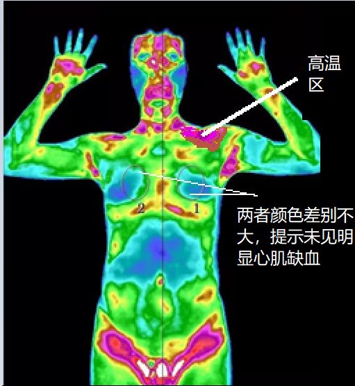 心悸胸闷头晕怎么回事,头晕心悸胸闷气短乏力嗜睡