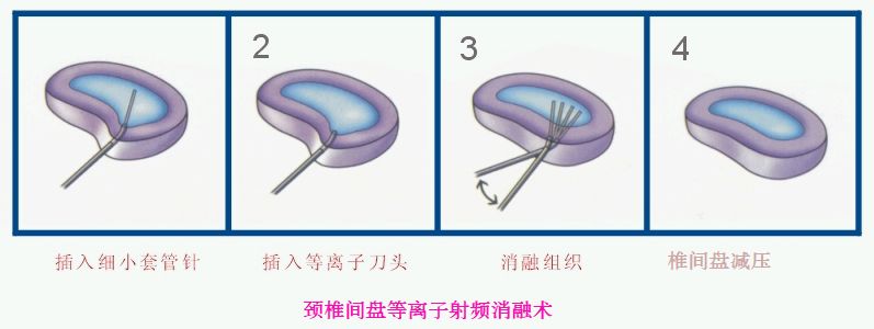 心悸胸闷头晕怎么回事,头晕心悸胸闷气短乏力嗜睡