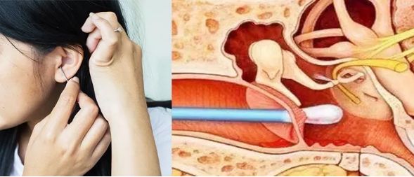 掏耳朵最舒服的耳勺,掏耳朵神器的正确使用方法