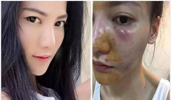 深扒美白成分不可不知的烟酰胺,高端美白针