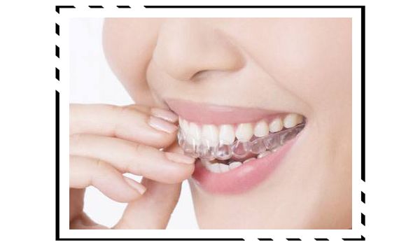 戴牙套换粗钢丝,拔四颗牙戴牙套的脸型变化图