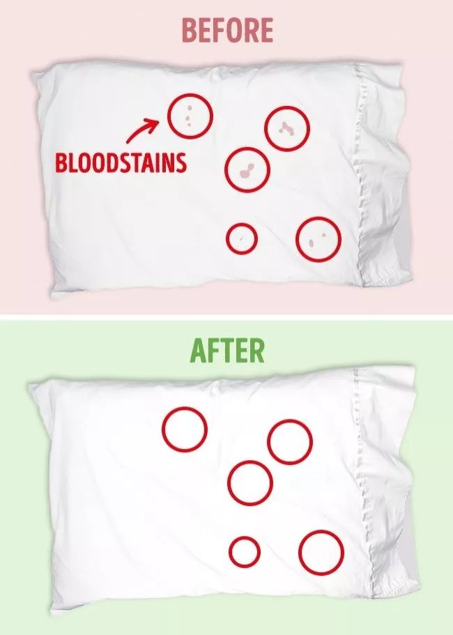 衣服发黄别扔了可以这样洗,衣服发黄用漂白剂能洗掉吗