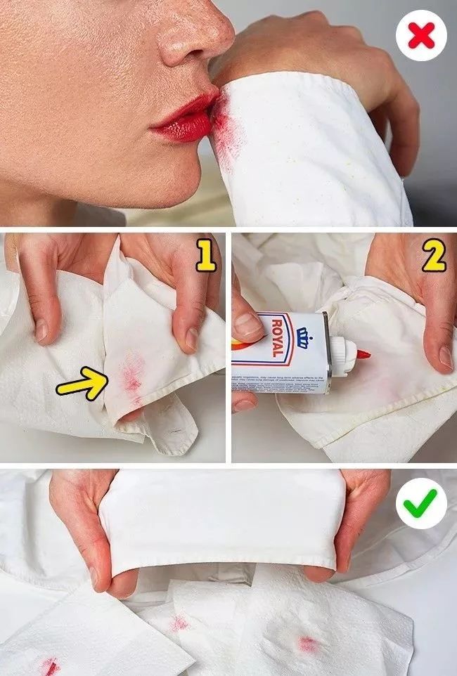 衣服发黄别扔了可以这样洗,衣服发黄用漂白剂能洗掉吗