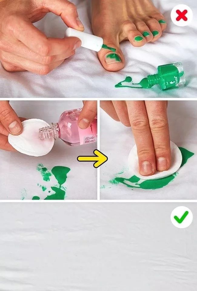 衣服发黄别扔了可以这样洗,衣服发黄用漂白剂能洗掉吗