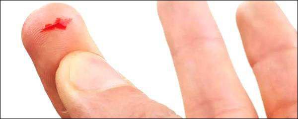 手指被纸划破为什么很痛,手指被纸划破为什么特别痛