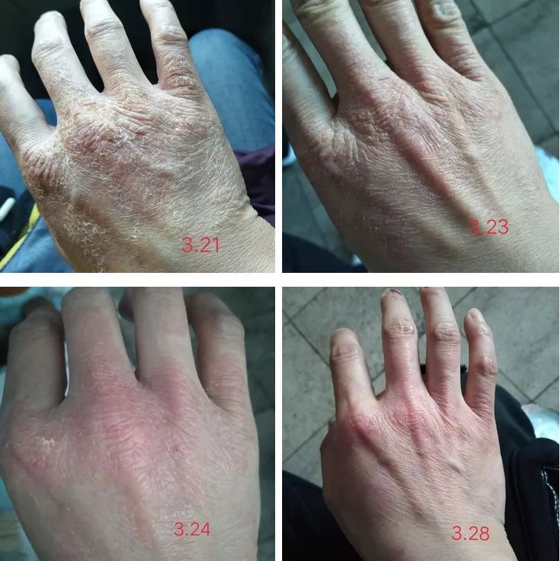 足部护理加长加热脚套,足部护理脚趾套品牌