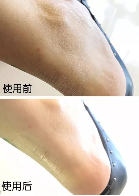 足部护理加长加热脚套,足部护理脚趾套品牌