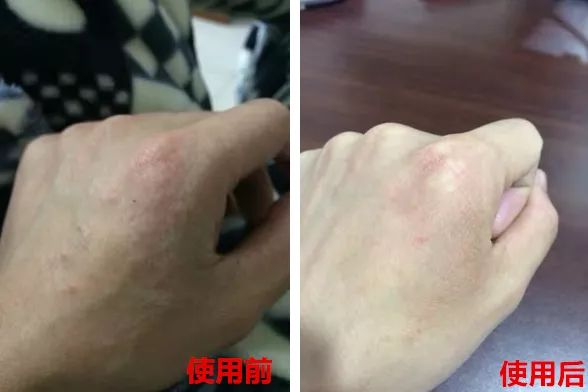 足部护理加长加热脚套,足部护理脚趾套品牌