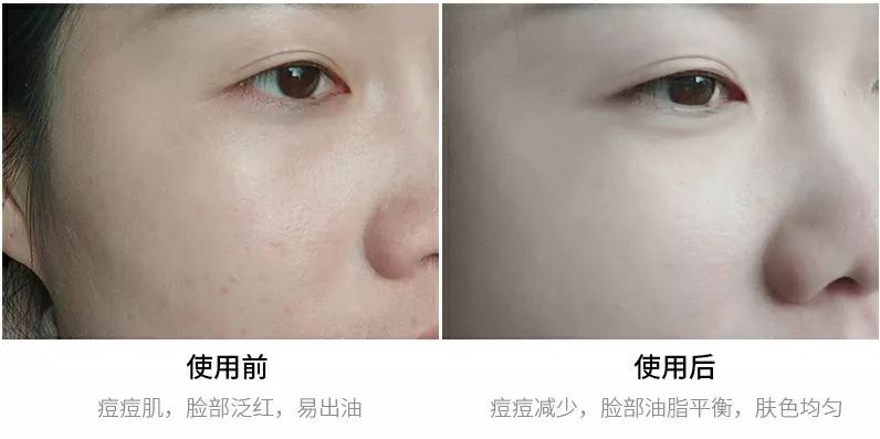 美白保湿平价精华推荐,米白精华平价好用