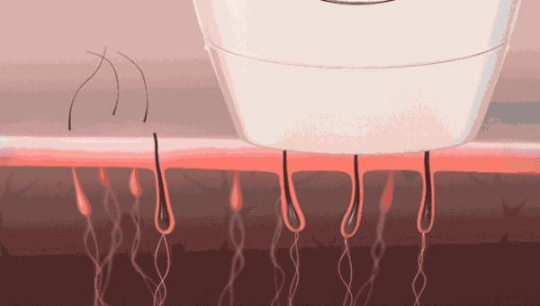 体毛旺盛的女生到底有多惨？？看着都疼啊啊啊啊