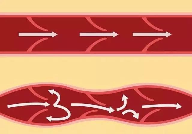 千万别乱挤痘痘一不小心就进了icu,挤掉痘痘后留了个洞