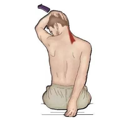 千万别乱挤痘痘一不小心就进了icu,挤掉痘痘后留了个洞