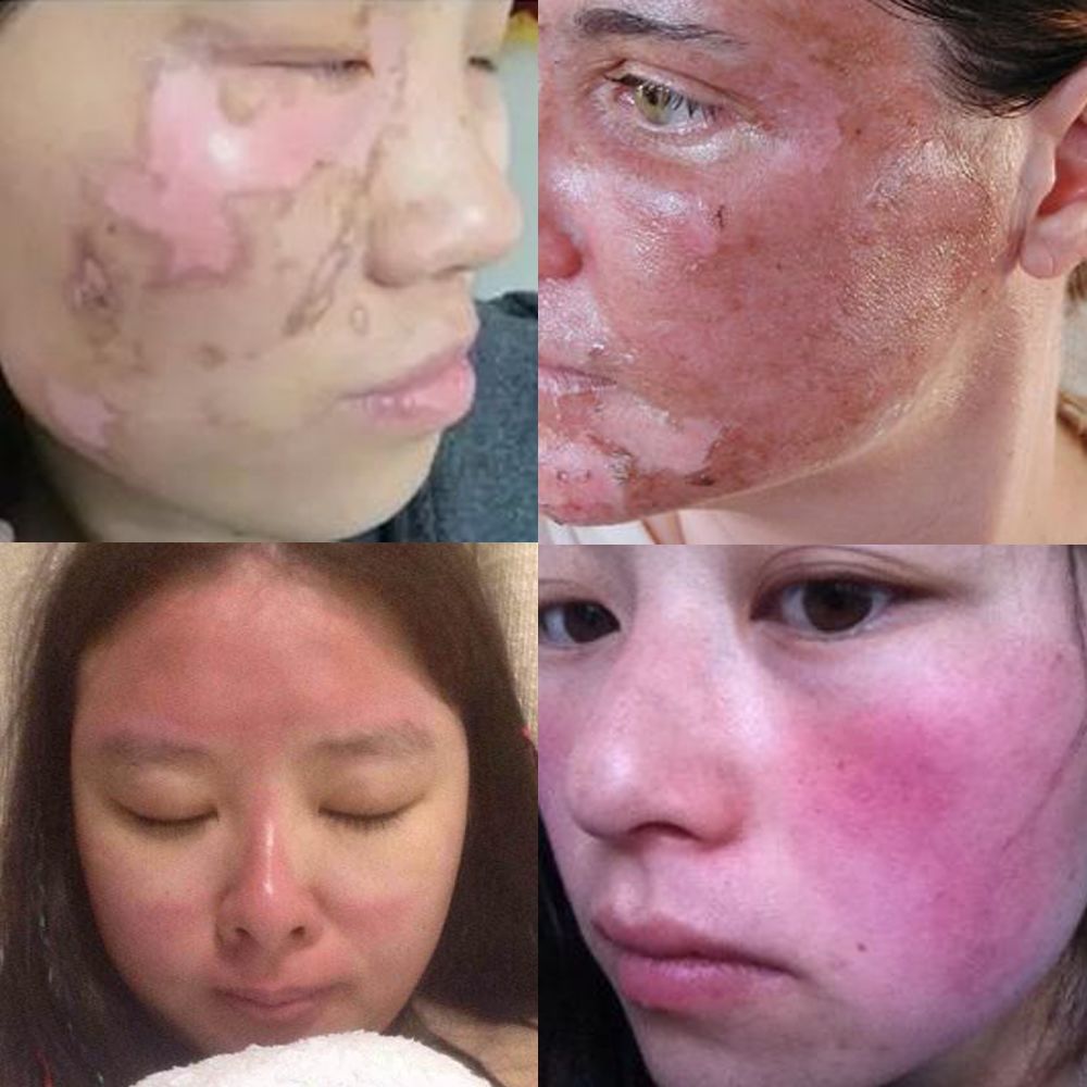 大s同款防晒帽太大怎么戴,防晒帽大s同款