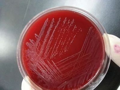 阴道炎复发率高,阴道炎老是复发喝中药能好吗