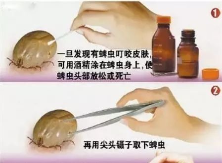 2岁小孩眼睛上突然长了一颗黑痣,2岁小孩眼皮上长了个红疙瘩