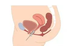 生娃后学会这8个小技巧,生娃时的呼吸用力方法