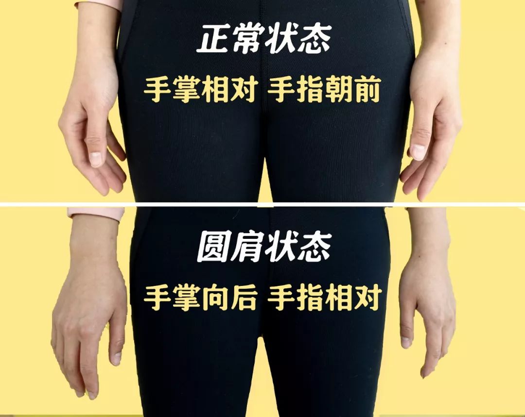 改善背部体态的动作,改善体态的瑜伽动作