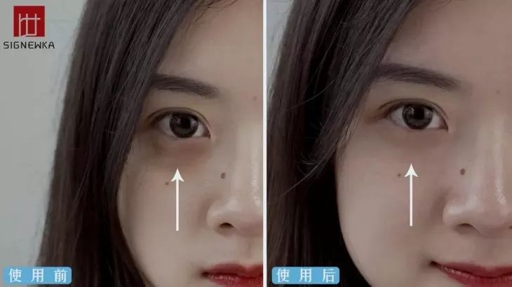 德国变态震动棒，啪啪啪间抚平眼袋、黑眼圈！不用开刀，就能让你年轻十岁！