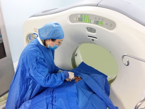 北京天坛医院三叉神经痛专家,天坛医院三叉神经手术费用