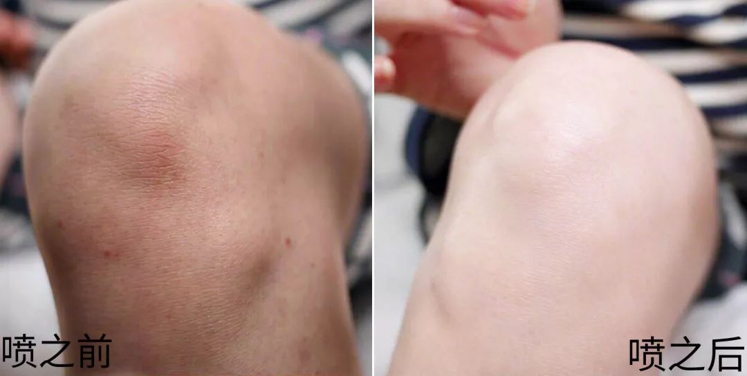 裸感美腿|1瓶=20双*袜丝**！3秒喷出“裸感”大美腿！隐形毛孔、鸡皮肤！短裙绝配