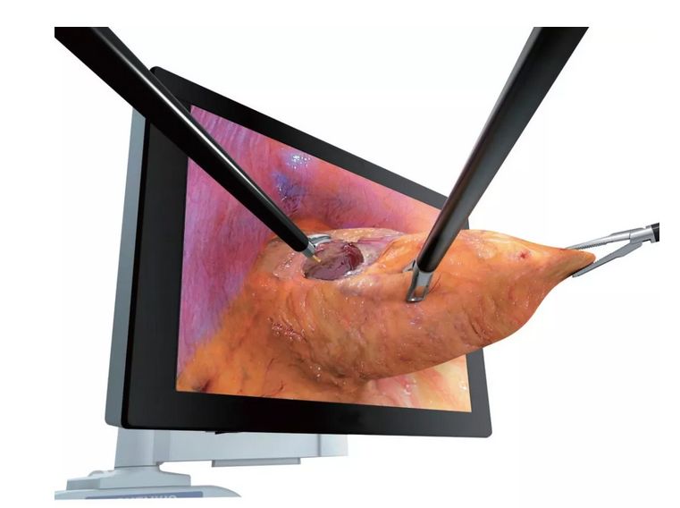 让无数女性尴尬的“社交癌”，医生戴着3D眼镜治好了！