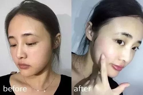 螨虫在脸上爬好不好,螨虫爬过的东西还能用吗