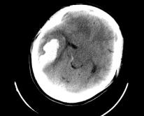 24岁护士怀孕后续,23岁护士怀孕