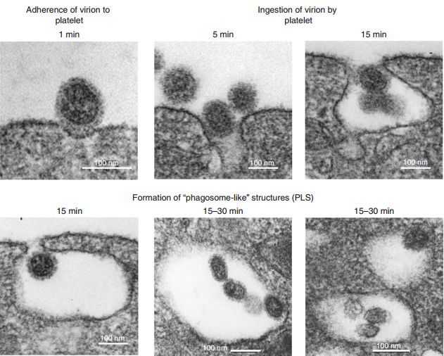 《自然》子刊：“吃货”血小板！科学家发现血小板能吞噬血液中的流感病毒，促进NET释放，或为流感增加心梗风险原因丨科学大发现