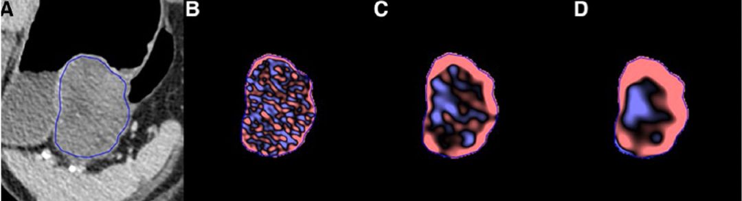 pubmed文献总结,pubmed文献综述类