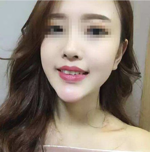 无锡缺牙优惠补贴多少钱,缺牙人士看过来种牙补贴免费领