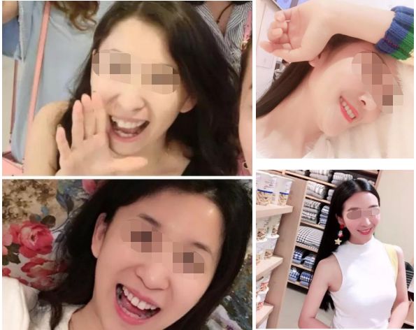 无锡缺牙优惠补贴多少钱,缺牙人士看过来种牙补贴免费领