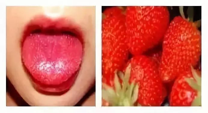 紧急提醒这些疾病已进入高发期,家长关注这种病进入高发期