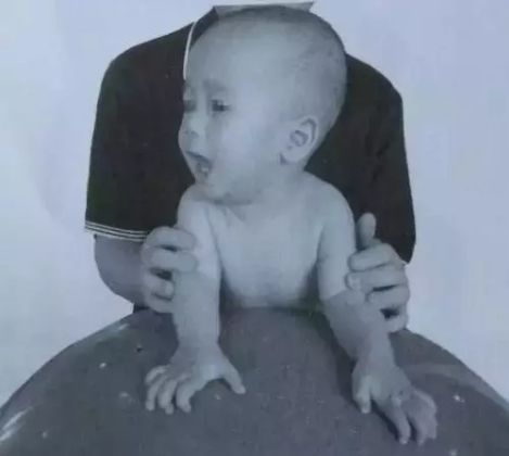 脑瘫儿童头往后仰怎么锻炼,脑瘫儿童抽搐四肢无力怎么办