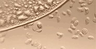 因为穿很紧的牛仔裤导致的妇科病,为什么牛仔裤穿了容易得妇科炎症