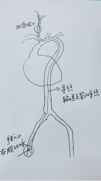 惊险男子身悬18楼外防火奋力营救,惊险浙江男子手被锯断不停喷血