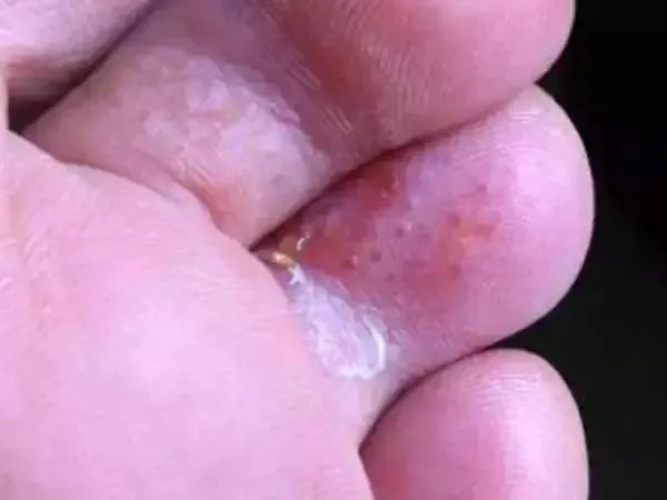 穿着最舒服不累脚的拖鞋,好穿不易脏的拖鞋