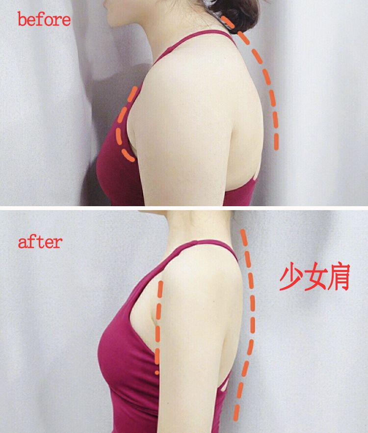 含胸驼背最损气质手把手教你纠正,含胸驼背如何改善提升气质