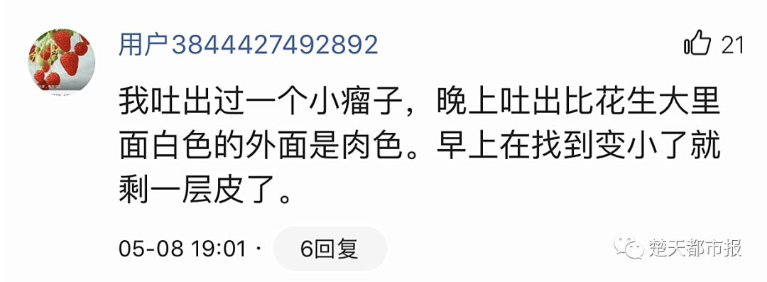 男子酒后吐出来大肿瘤,男子喝酒吐出来一个肿瘤