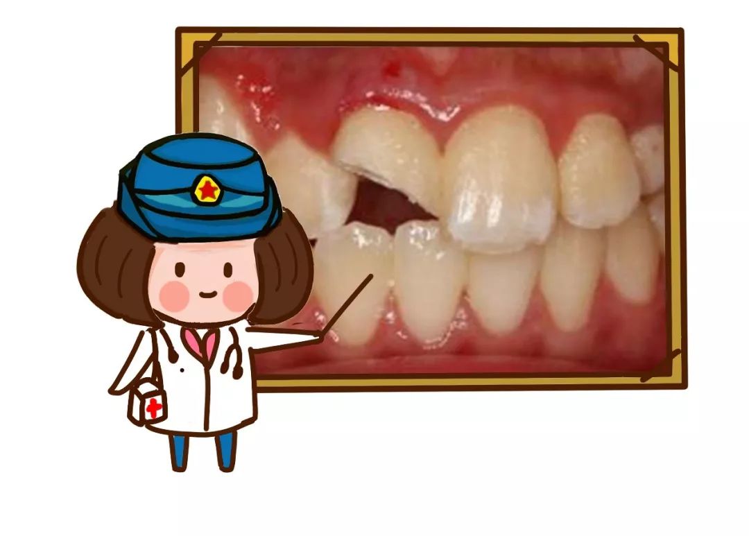 牙外伤序列治疗,军医出现医疗事故会怎么处理