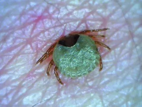 草爬子怎么危及生命,草爬子被咬了怎么拔出来