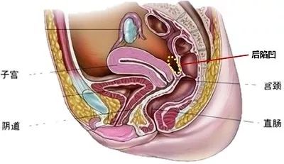 宫颈糜烂是不是妇科病最严重的,妇科宫颈糜烂怎样能治好