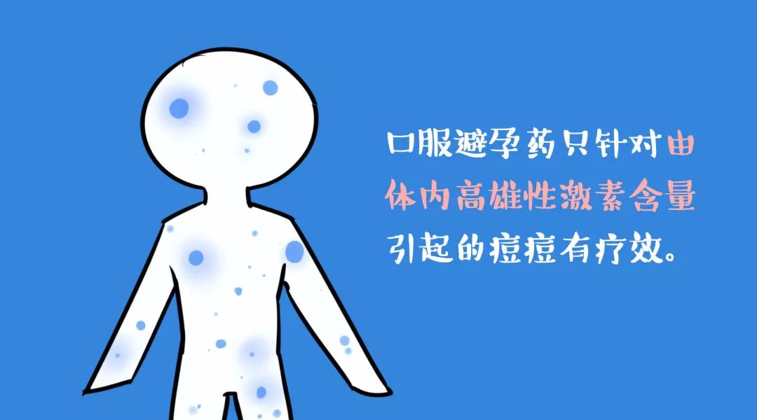 辟谣特工队|吃避孕药能战“痘”成功吗？